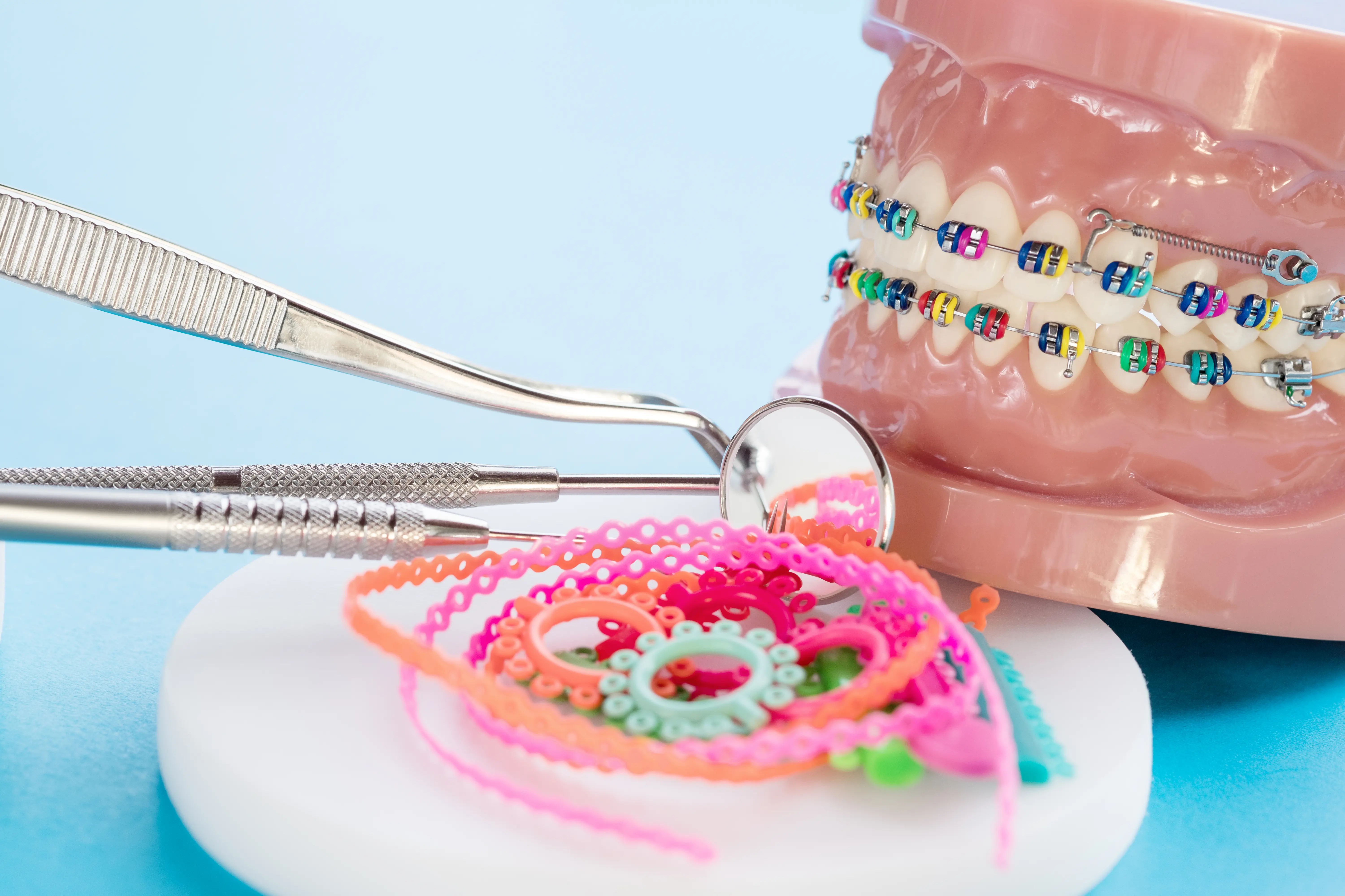 Self-ligating braces in Vizag — advanced orthodontic technology
