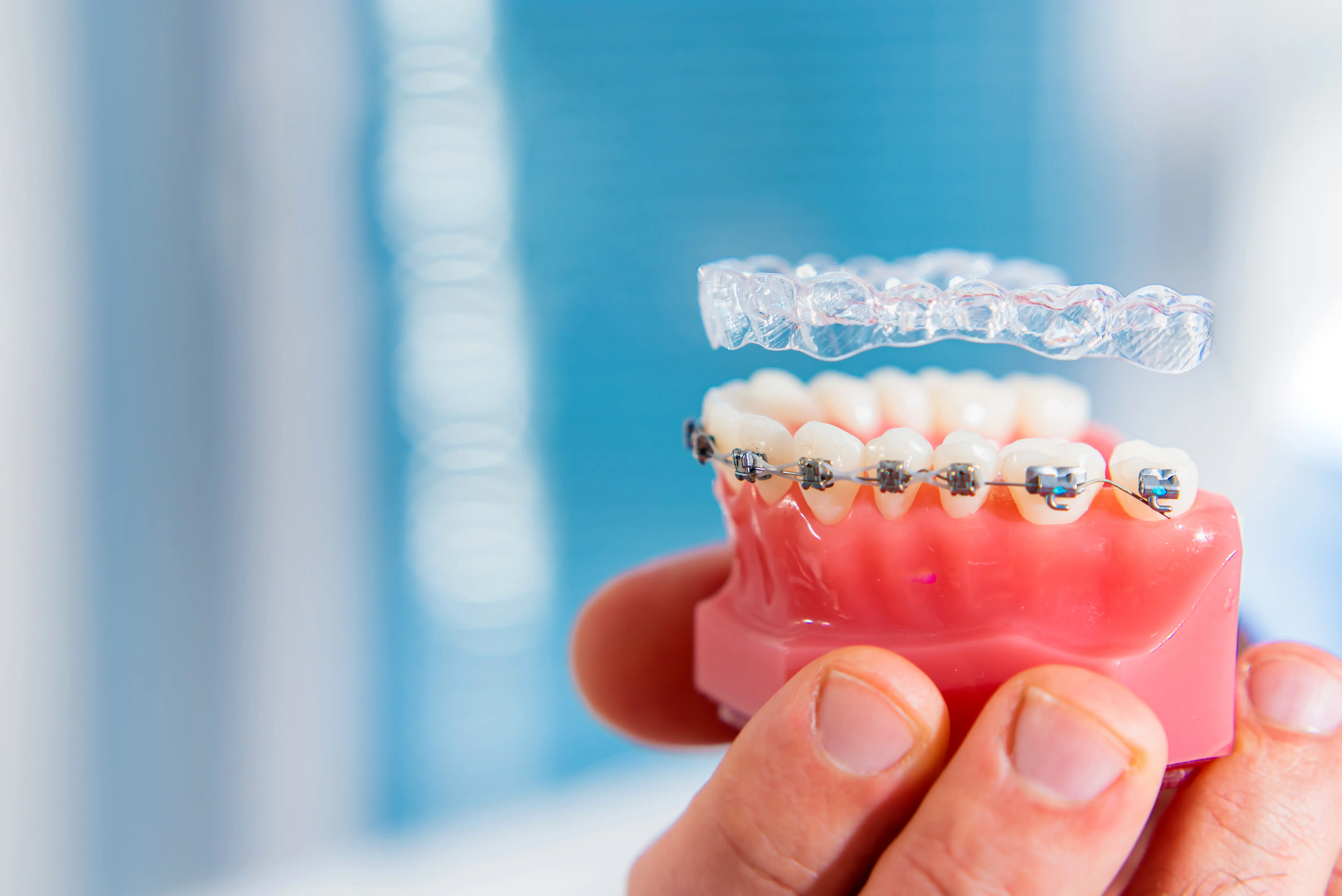 Invisalign braces and clear aligners at Ravi's Dental Care Vizag