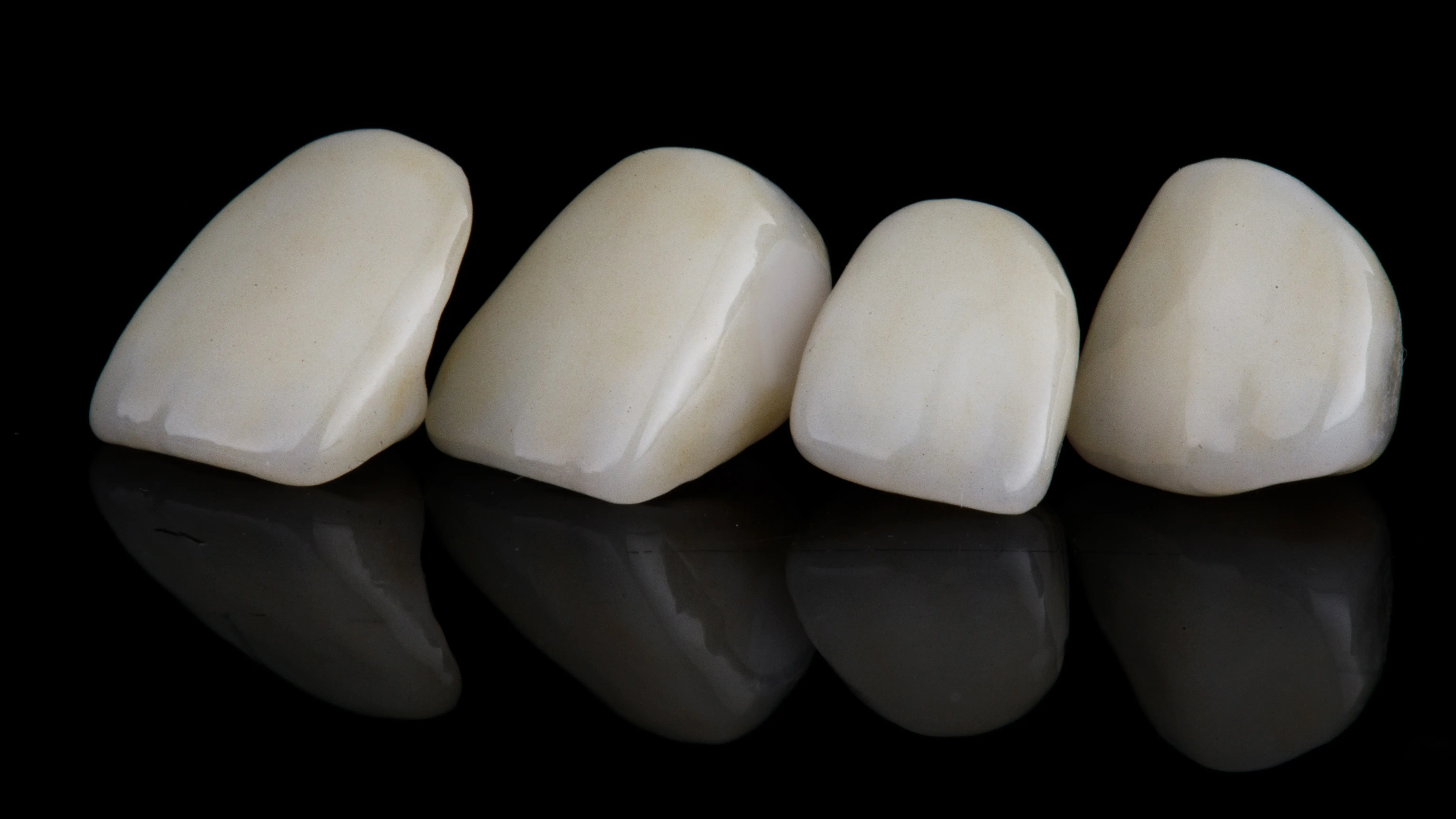 Crown and bridge procedure at Ravi's Dental Care Vizag