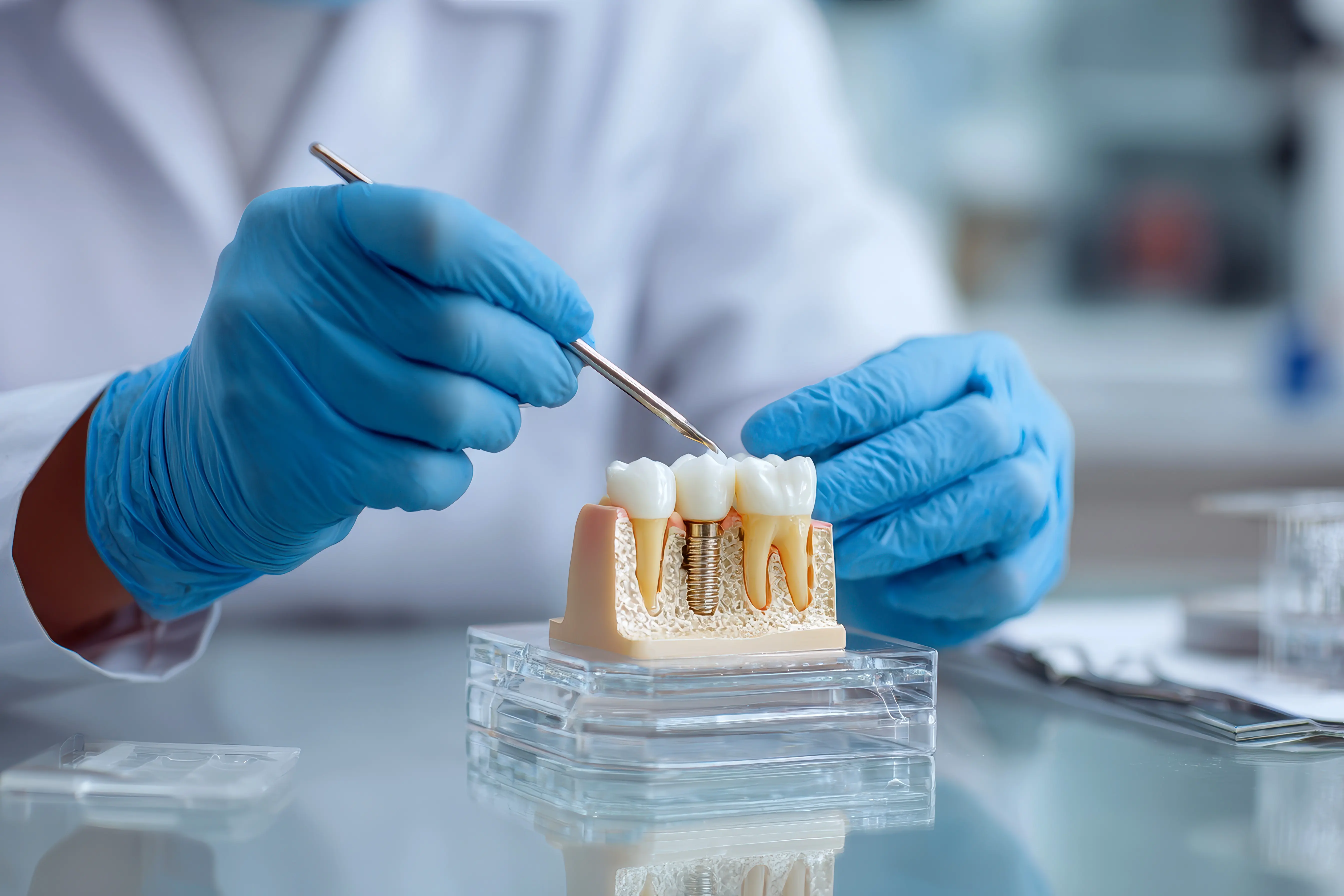 Dental implants with 3D digital planning at Ravi's Dental Care Vizag
