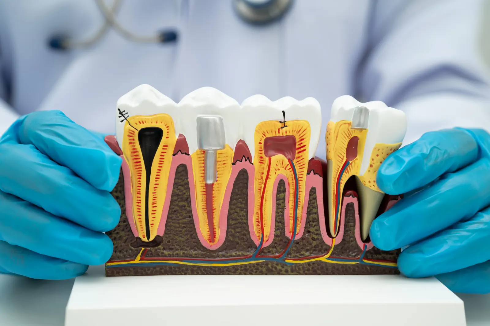 MDS endodontist performing magnification-assisted root canal retreatment in MVP Colony, Vizag