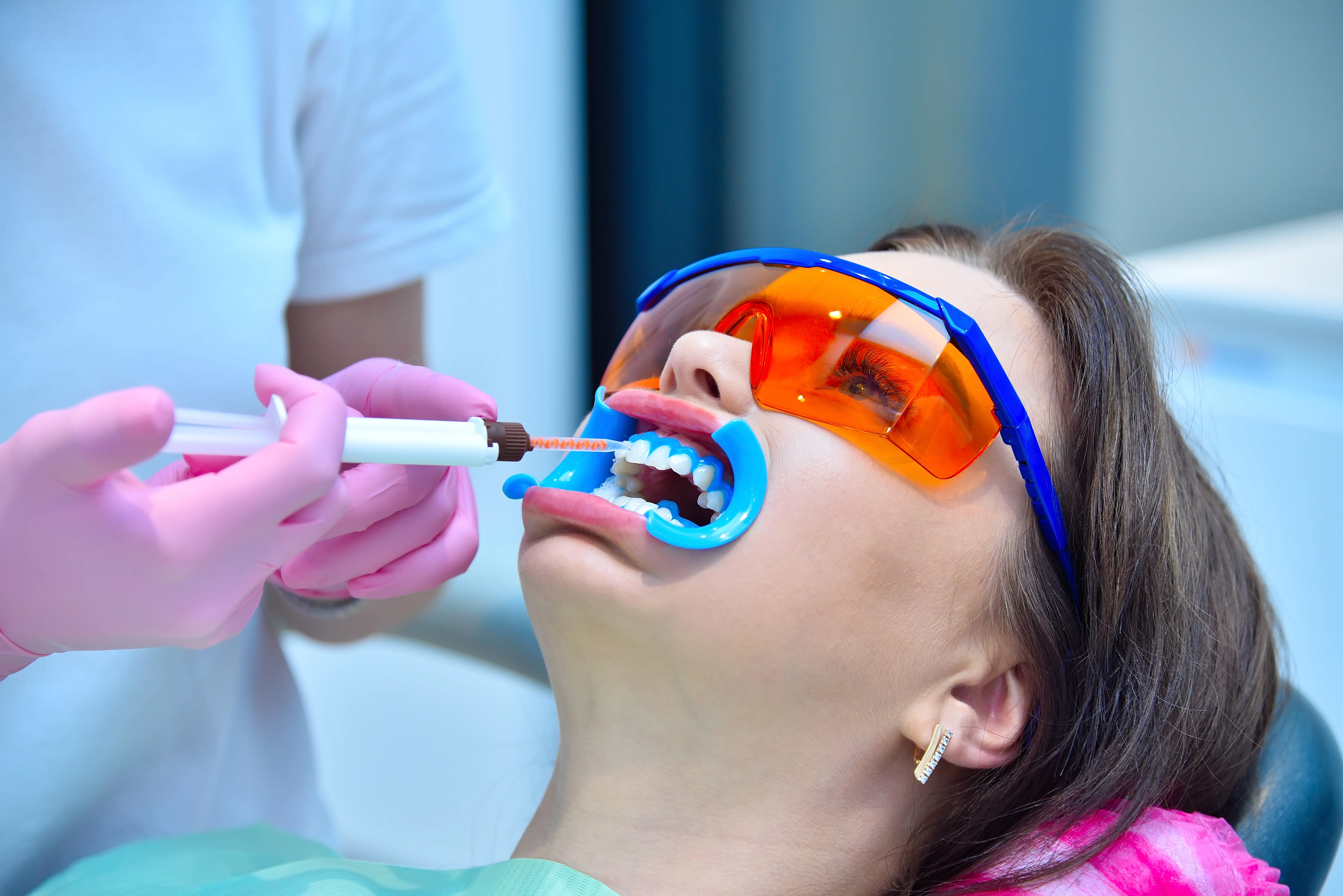 Teeth whitening before and after results at Ravi's Dental Care Vizag