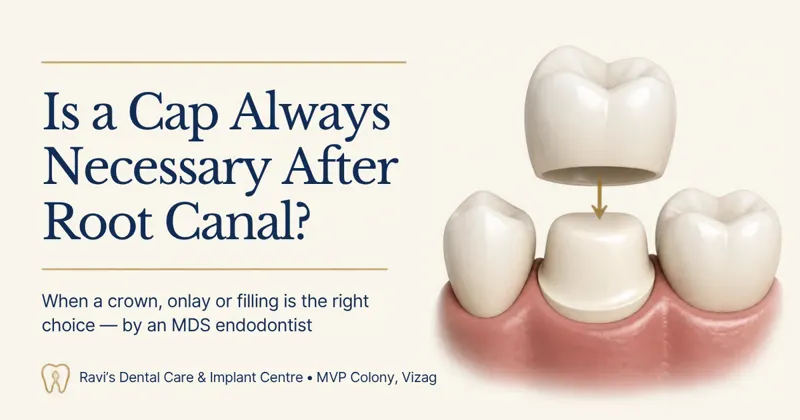 Is a Cap (Crown) Always Necessary After Root Canal Treatment?