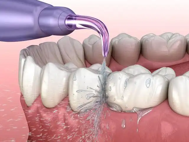 Why Flossing Matters