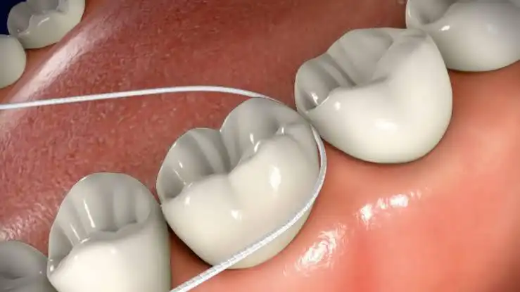 Why Flossing Matters