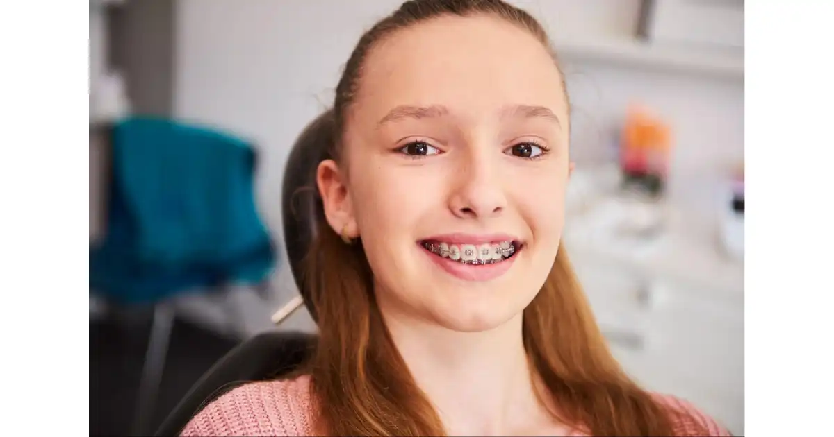 How to Care for Your Teeth with Braces: A Complete Guide